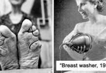 30 Unimaginable Things Women Did In The Past Just For The Sake Of ‘Beauty’